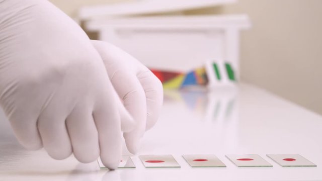 A close-up of a medical technician taking microscope slide glasses for doing testing. Complete blood count (CBC) in medical laboratory. Isolated, on background