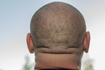 man with head