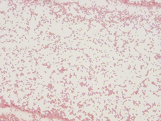 Microbiological microscope photograph