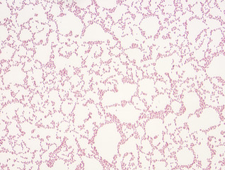 Microbiological microscope photograph