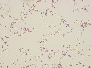 Microbiological microscope photograph