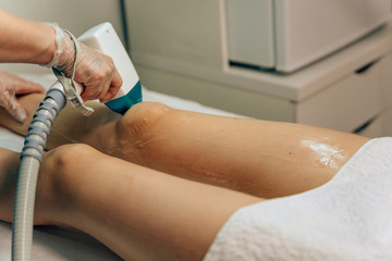 Laser hair removal girls. Hair removal on the legs of a woman. Destruction of the hair follicles...