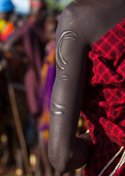Bodi Tribe Woman With Scarifications On Her Arm, Hana Mursi, Omo Valley, Ethiopia