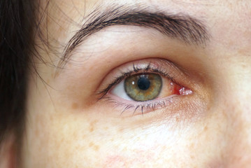 closeup of an eye