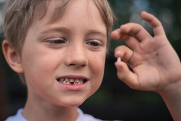6 years old boy shows the ruptured milk tooth