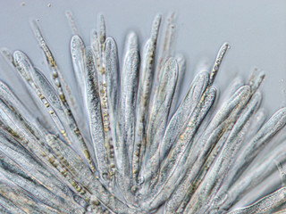microscopic view of Lachnellula ellisiana cup fungus showing spores, asci and paraphyses