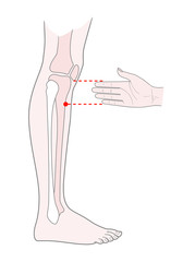 Active acupuncture points on the legs:  below the knee.