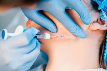 Non-surgical mandibuloplasty - close up - the doctor injects a patient with a syringe under the skin of hyaluronic acid (fillers)
