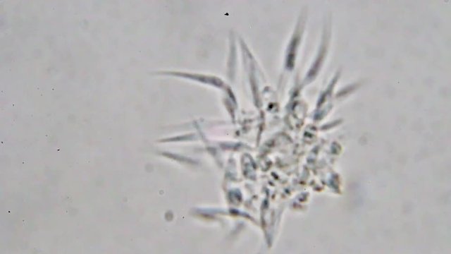 Trypanosoma cruzi microscope view; human diseases