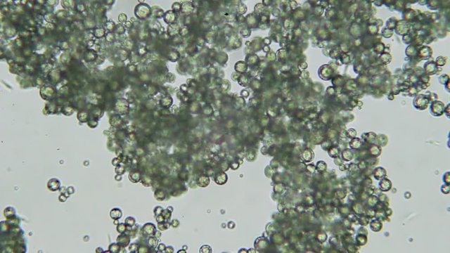 Trypanosoma cruzi microscope view; human diseases