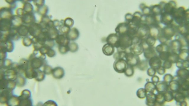 Trypanosoma cruzi microscope view; human diseases