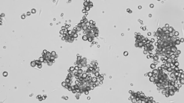 Trypanosoma cruzi microscope view; human diseases