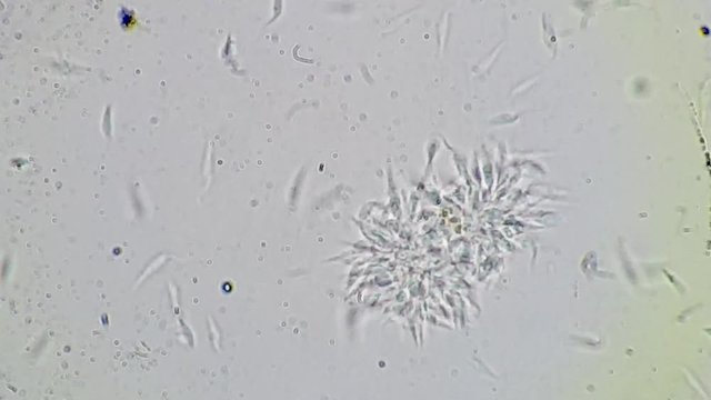 Trypanosoma cruzi microscope view; human diseases