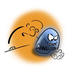 Ganglion on the palm side of the wrist