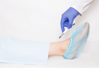A doctor holds a scalpel on the background of the ankle joint on the leg. A concept of modern surgery for endoprosthetics of the joints and the backstop of the foot, copy space