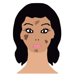 Face with pigmentation. Brown spots on the skin. Infographics. Vector illustration on isolated background.