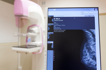 Modern digital mammography unit at clinic