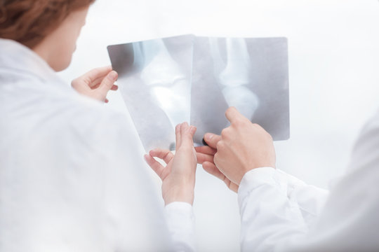 doctors are diagnosticians discussing x ray of patient