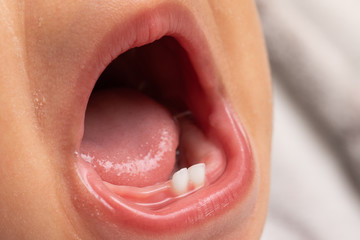 The mouth of a screaming infant is viewed close up, revealing baby teeth in the bottom gum....