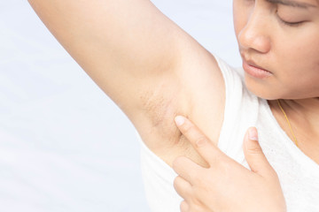 Women problem black armpit on white background for skin care and beauty concept