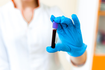 Testing blood sample in the hand of a female technician in the laboratory. Woman's hand in...