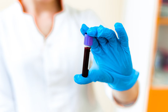 Testing blood sample in the hand of a female technician in the laboratory. Woman's hand in protective blue glove is holding a small vial of blood on the blurred background.