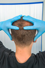 Guy in blue latex holding his head. Male pattern baldness. Mesotherapy of the scalp. Bald on the...