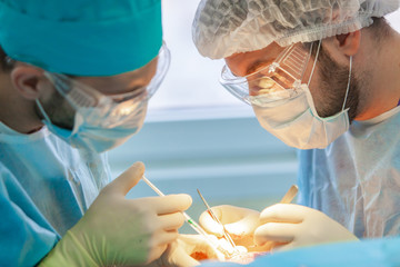 Baldness treatment. Hair transplant. Surgeons in the operating room carry out hair transplant...