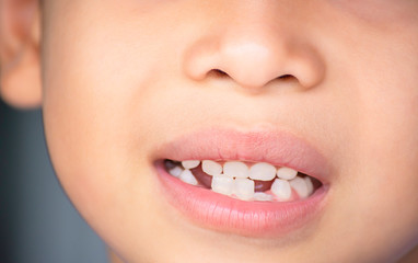 Baby teeth are just dropped in the mouth and regenerate tooth.