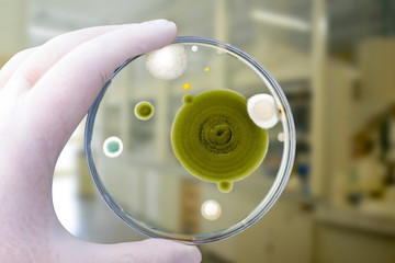 Colonies of different mold fungi grown from indoor air on Petri dish with Sabourad dextrose agar,...