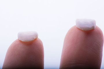 dental veneers and crowns