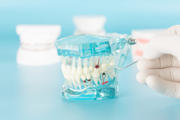 Dental tool with model in dental care concept. - obrazy, fototapety, plakaty