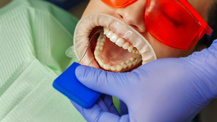 Dentist examines the condition of the teeth of upper jaw of girl patient. Dental clinic. Health care. © Vagengeim