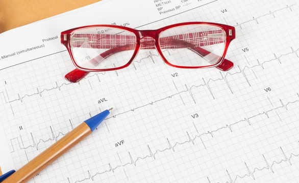 ECG diagram,EKG diagram,medical result