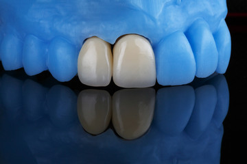 high-quality crowns on the blue model, shot on black glass with reflection and composition