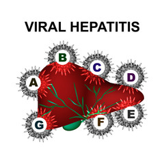 Types of viral hepatitis. Hepatitis A, B, C, D, E, F, G. World Hepatitis Day. Infographics. Vector illustration on isolated background.
