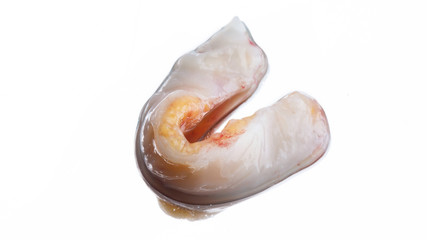 flap of soft tissue of the patient to restore the gums