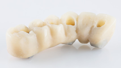 Dental polymer prosthesis for temporary prosthetics on a white background