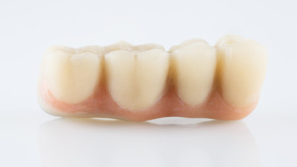 macro photo of a dental prosthesis made of polymer on a white background