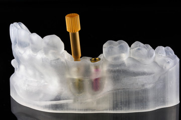 Dental polymer model with base abutments for crowns