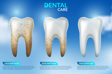 Teeth whitening 3d concept. Comparison of clean and dirty tooth before and after whitening 