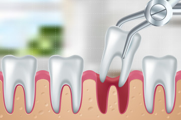 Dental concept. Vector poster. Dentistry and Stomatology