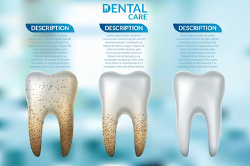 Teeth whitening 3d concept. Comparison of clean and dirty tooth before and after whitening treatment.
