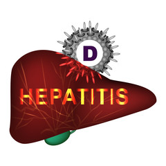Hepatitis D. World Hepatitis Day. Infographics. Vector illustration on isolated background.