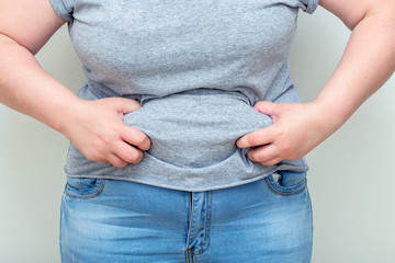 Obesity. Obese Woman Holding His Belly Fat With Both Hands Giving An Expression Of Shock.