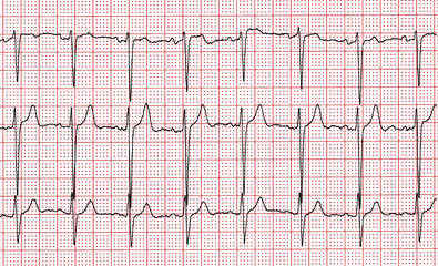 Cardiogram. Fragment of research result by CU