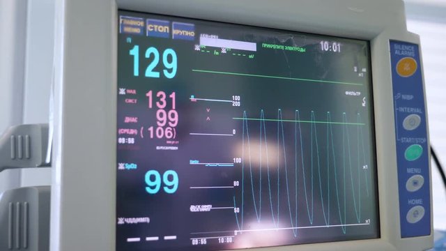 Modern monitor displays heart rate of a patient during surgery.