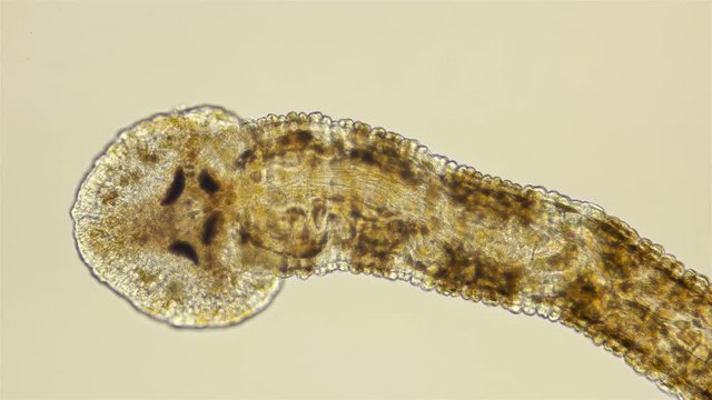 Leech. Fish leech Piscicola under the microscope. A parasite that attaches to fish and sucks blood from them, from the family of annelids. With mass reproduction can cause serious damage to fisheries.