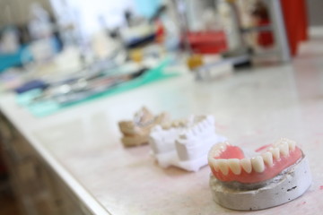 Dental teeth restoration