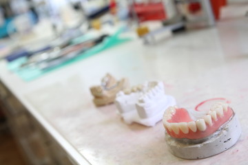 Dental teeth restoration